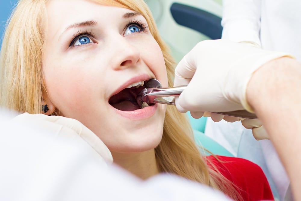Tooth Extraction - Shalimar Family Dentistry