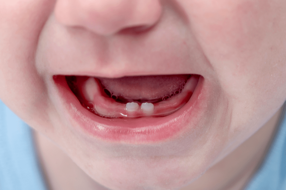 Eruption of Your Child’s Teeth