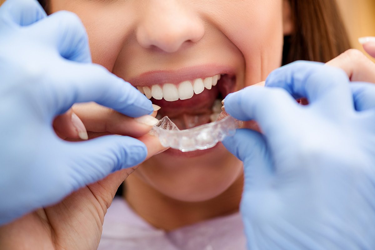 Orthodontist-with-Invisalign-patient