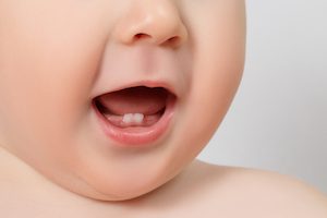 Close-up Baby mouth with two rises teeth